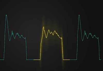 Fault detection in fuel injection